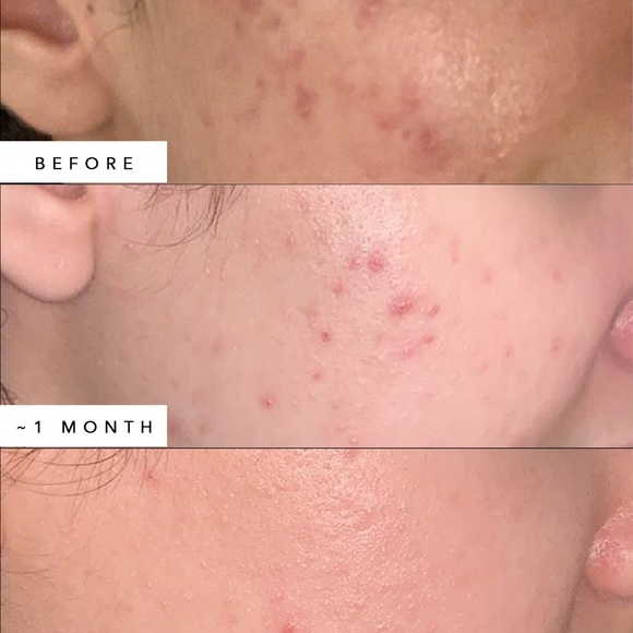 HERBIVORE BOTANICALS Lapis Blue Tansy Face Oil Full Size - Picture 3 of 11